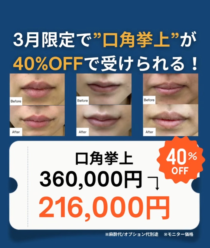 口角拳上キャンペーン